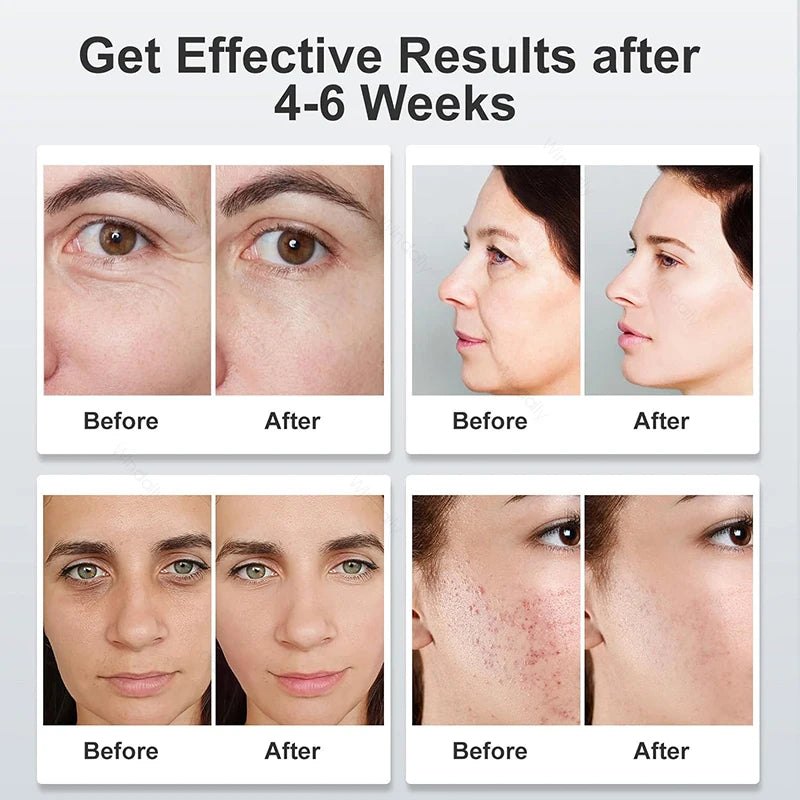 Maschera di bellezza a LED a 7 colori – Strumento ricaricabile per la cura della pelle