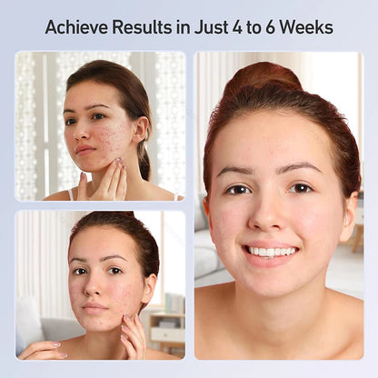 Maschera di bellezza a LED a 7 colori – Strumento ricaricabile per la cura della pelle