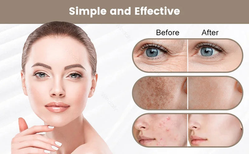 Maschera di bellezza a LED a 7 colori – Strumento ricaricabile per la cura della pelle