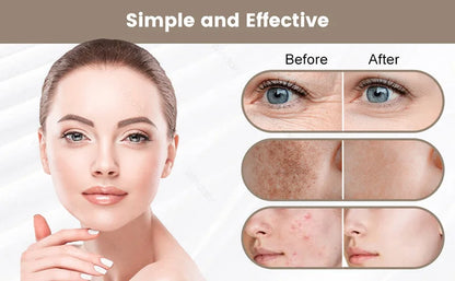 Maschera di bellezza a LED a 7 colori – Strumento ricaricabile per la cura della pelle