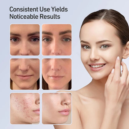 Maschera di bellezza a LED a 7 colori – Strumento ricaricabile per la cura della pelle